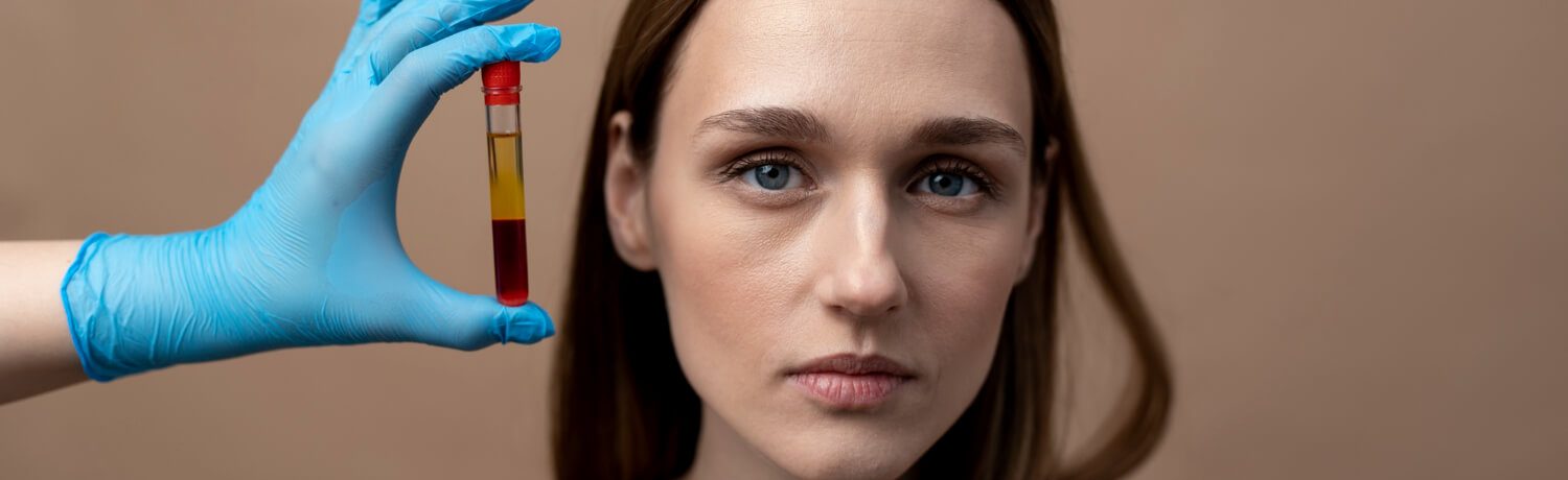 Plasma_rico_plaquetas_eslait