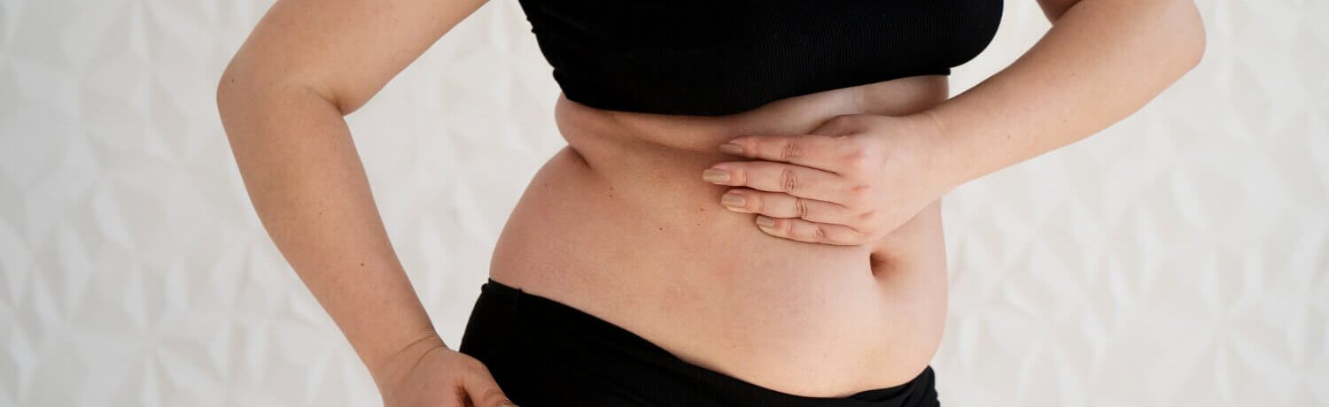 abdominoplastia_eslait