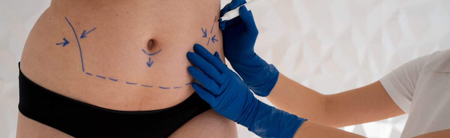 lipoescultura_laser_eslait