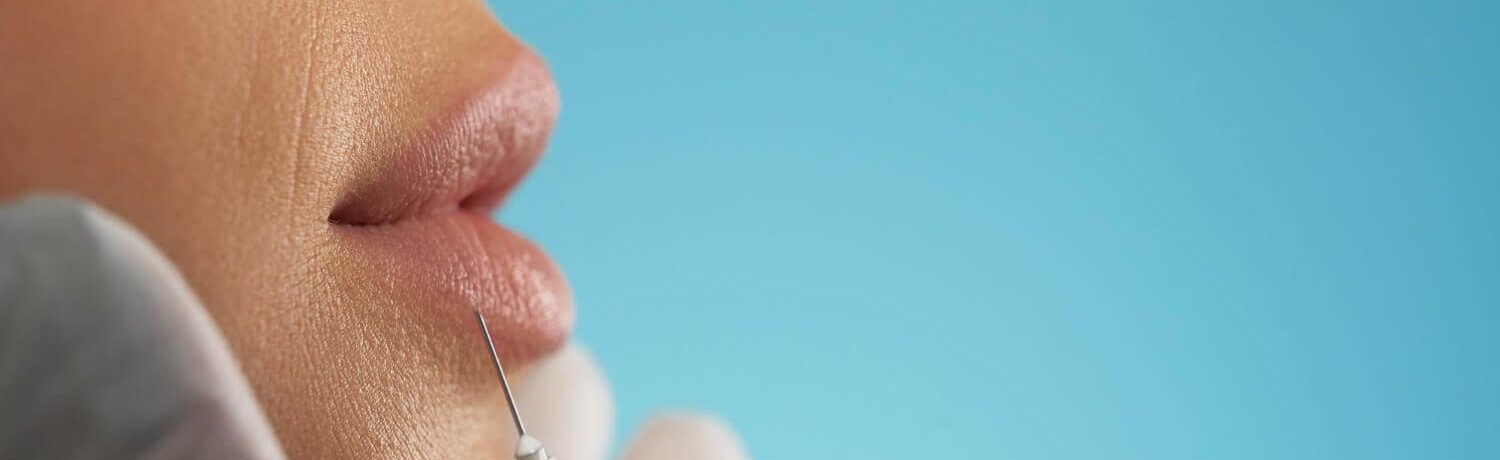 rellenos_faciales_eslait